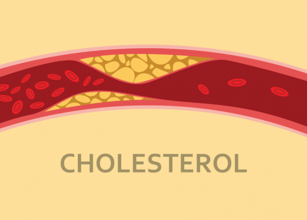 Cholesterol là chất mỡ cơ thể bạn cần để hoạt động