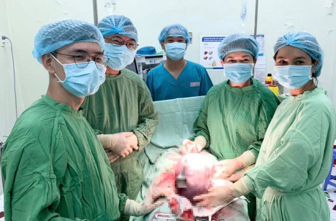 Một ca phẫu thuật u nang buồng trứng kích thướng lớn thành công cho 1 bệnh nhân ở Đồng Tháp