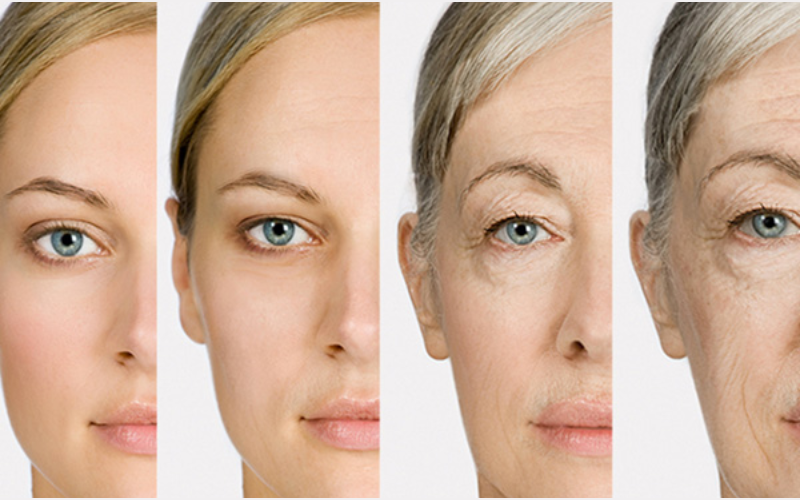 Nếp nhăn xung quanh vùng mắt khiến bạn trông già hơn tuổi và kém thẩm mỹ.