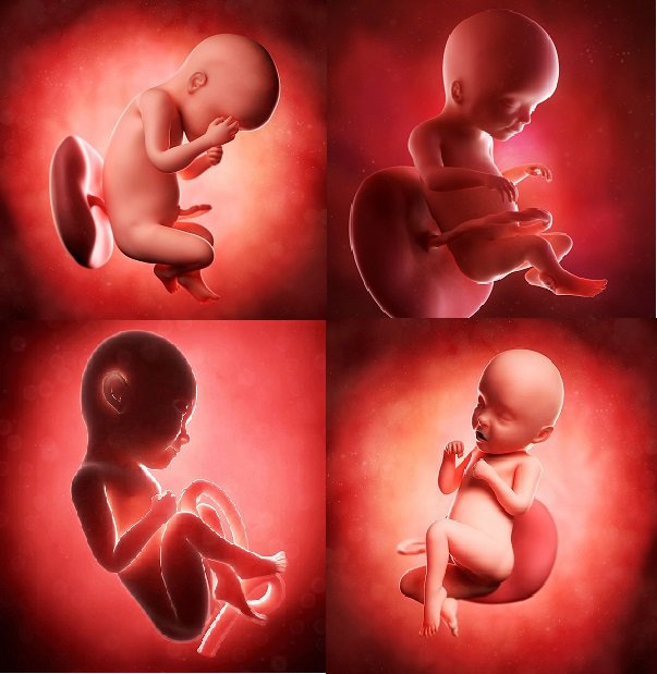 Ngay từ khi trong bụng mẹ, trẻ đã có thể mắc các dị tật bẩm sinh do các nguyên nhân khác nhau