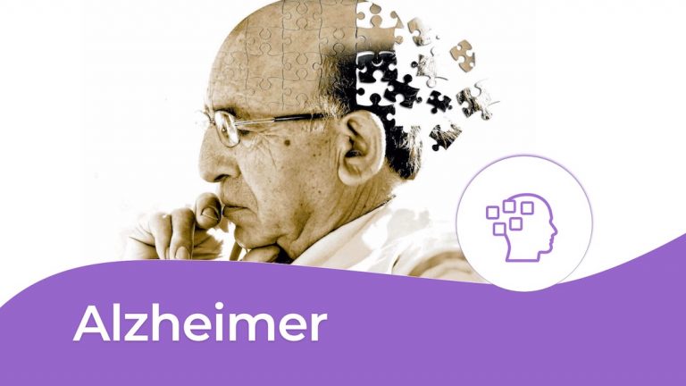Alzheimer là một chứng bệnh mất trí nhớ thường hay gặp ở những người cao tuổi